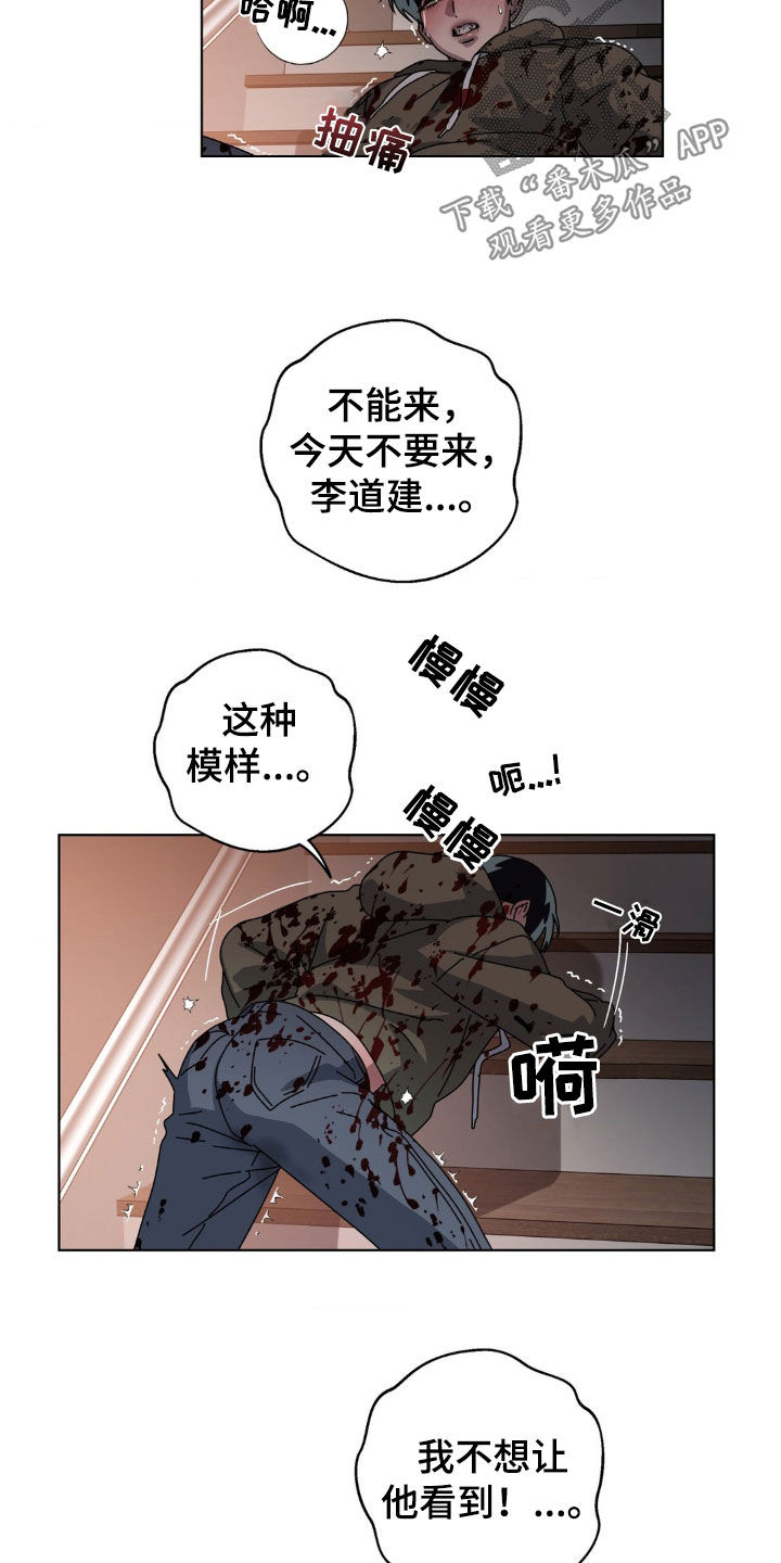 在深渊等你漫画,第20章：血雨3图