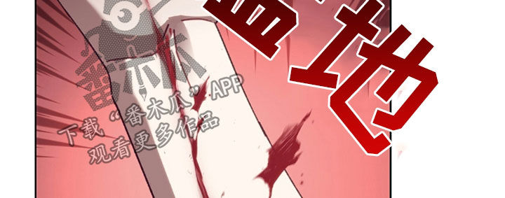 误入狼群漫画,第34章：伤得很重2图