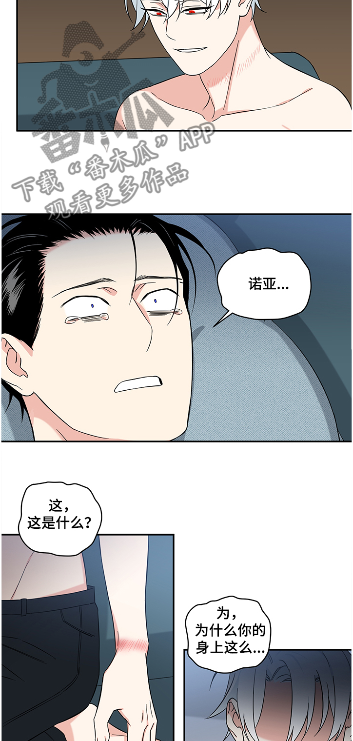 面瘫英雄里奥漫画,第99章：【后记】伤痕4图