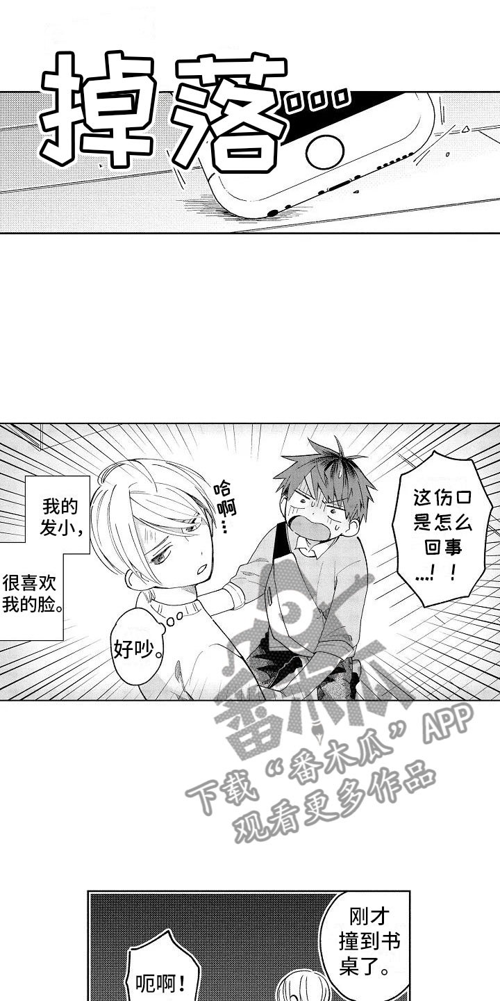 竹马我无法拒绝漫画,第4章：受伤也不赖3图