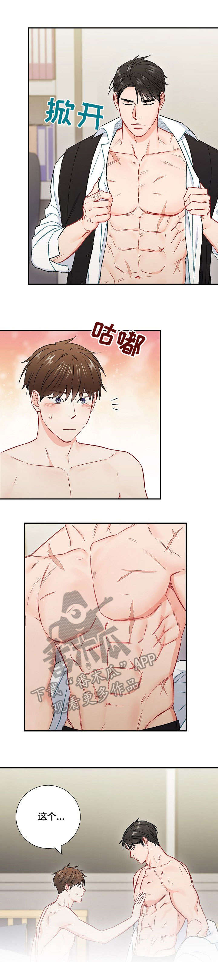 意外接触漫画,第59章：疤痕1图