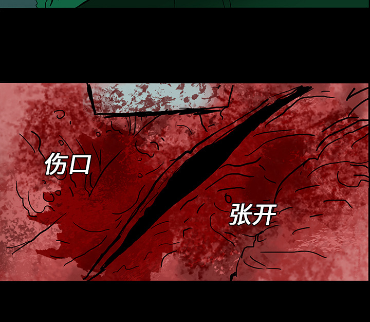 医院的诅咒漫画,第15章：再次手术5图