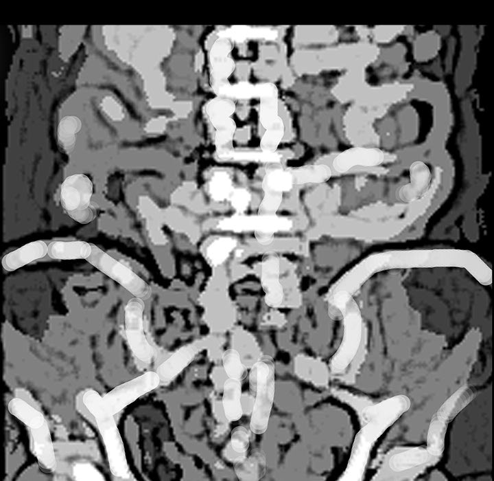 医院的诅咒漫画,第7章：满月4图