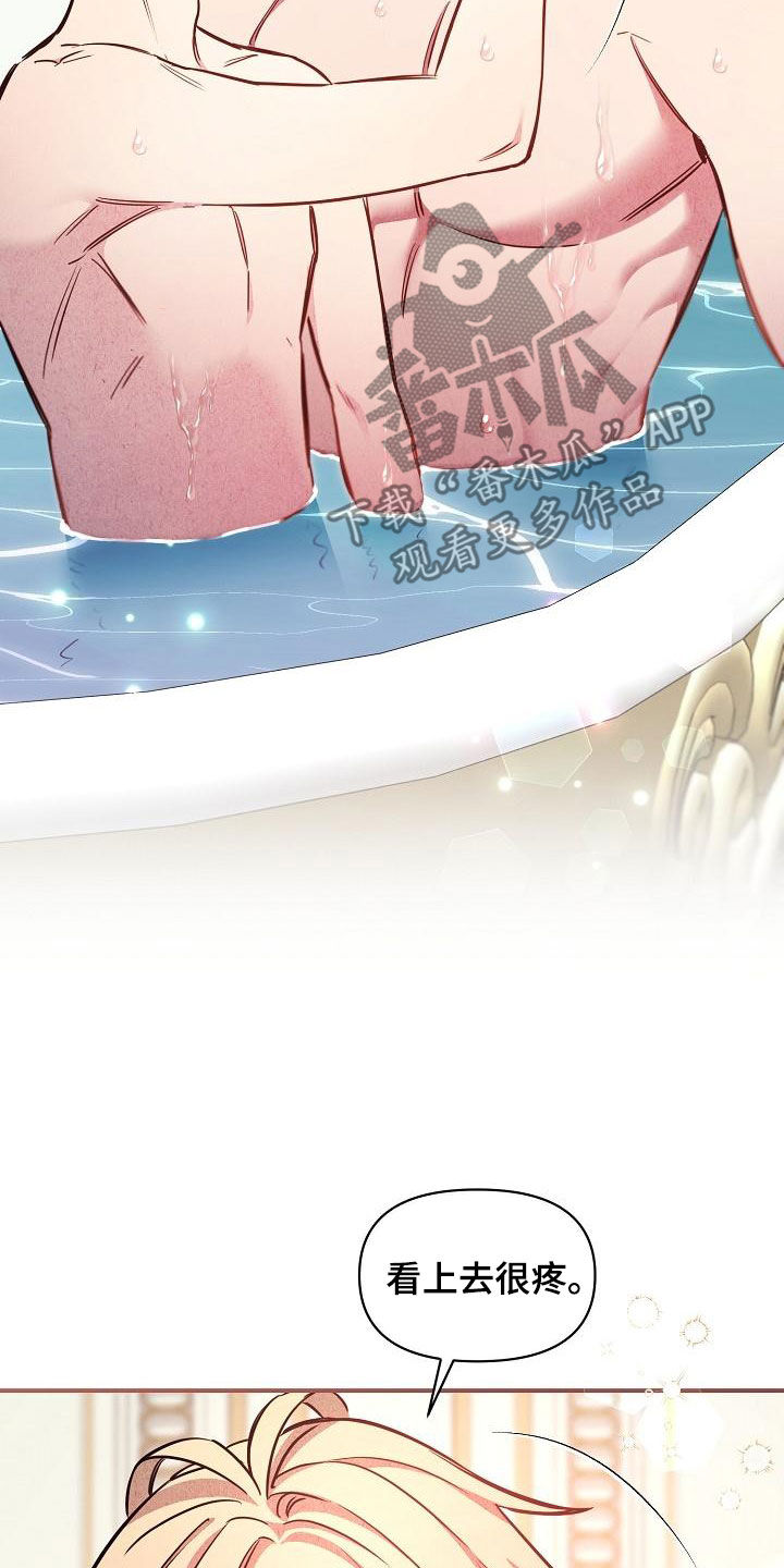 绝望列车10集漫画,第86章：【第二季】伤疤2图