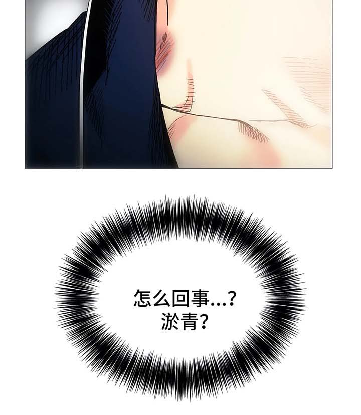 固执爱人漫画,第43章：淤青1图