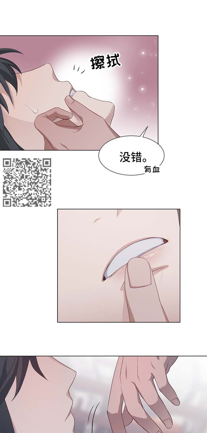 灵魂置换漫画,第38章：受损5图