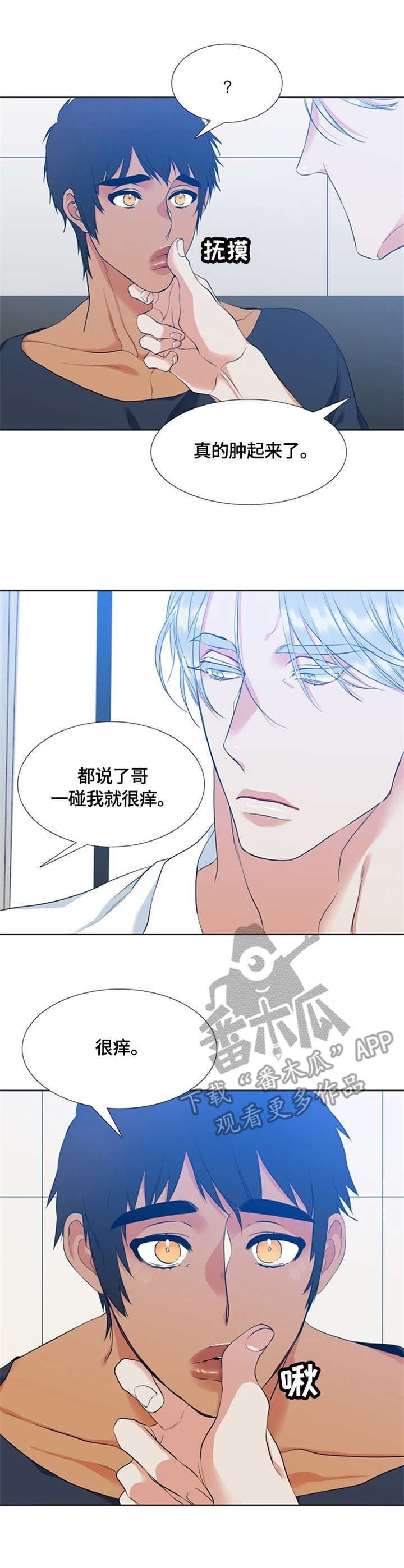 候鸟漫画,第18章：肿了5图