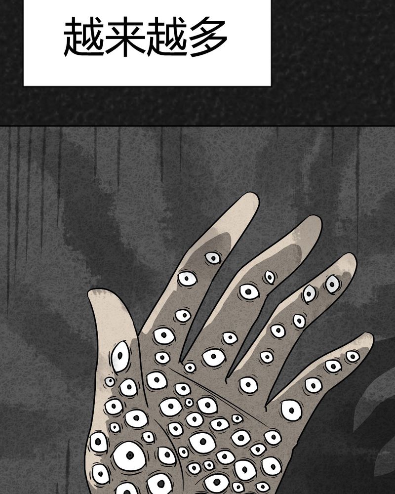 猎悚短话漫画,第37章：怪病上篇1图